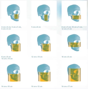 rangexray1.png